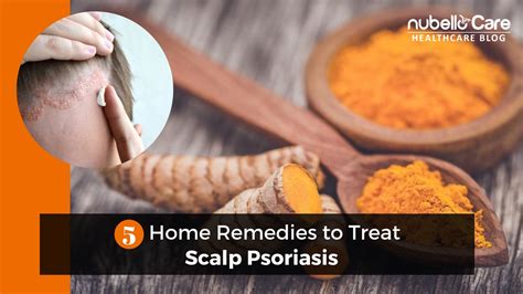 Home Remedies To Treat Scalp Psoriasis At Home Nubello Care