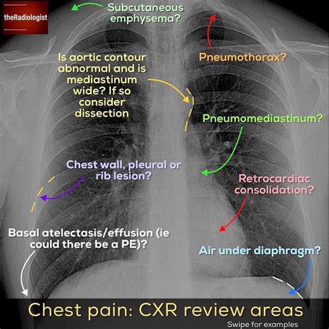 A collection of anatomy notes covering the key anatomy concepts that medical students need to learn. Pin on Radiology Anatomy