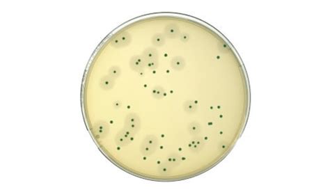 Listeria Monocytogenes Agar Listeria Chromogenic Agar Base According