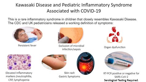 Pediatric Multi System Inflammatory Syndrome Partially Associated With