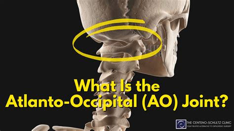 Atlanto Occipital Joint Labeled