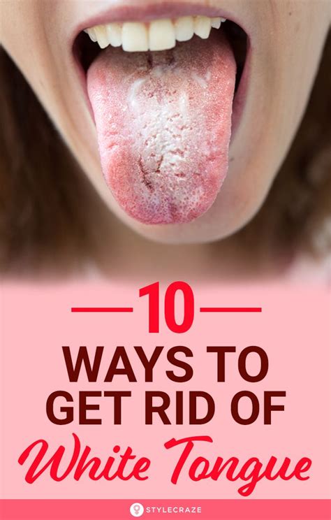 How do i get rid of tongue buildup? 10 Ways To Get Rid Of White Tongue And Make It Healthier ...