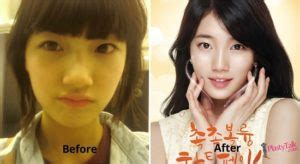 What is the respond of bae yong joon regarding plastic surgery allegation? Then and Now: Let's See Suzy's Facial Transformation. Did ...