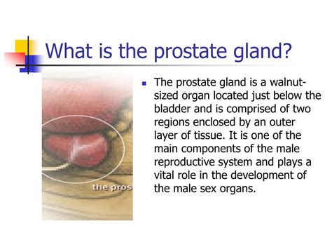 PPT The Prostate Gland Prostate Cancer Brachytherapy PowerPoint
