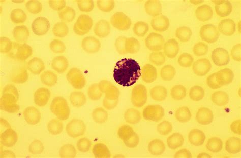 Basophil White Blood Cell License Image 70336871 Lookphotos