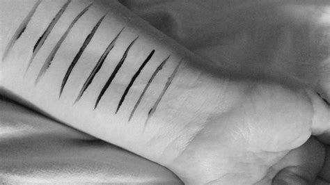 How To Hide Scars On Arms Living With Scars