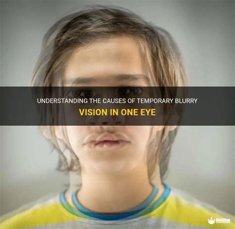 Understanding The Causes Of Temporary Blurry Vision In One Eye Medshun