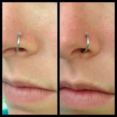 how to make my nose piercing heal faster best sale save 46 ph