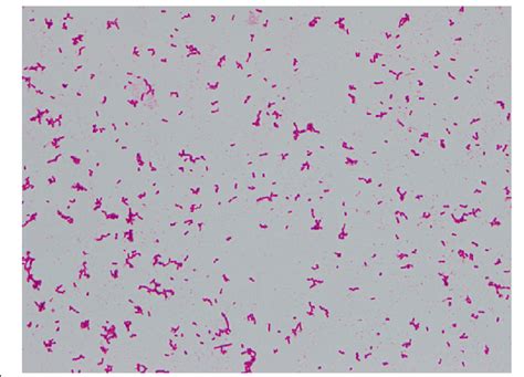 Gram Stain Of The Organism Isolated From Blood Culture Magnification