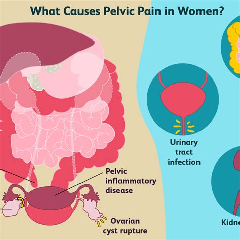 Severe Pelvic Floor Pain Pregnancy Review Home Co