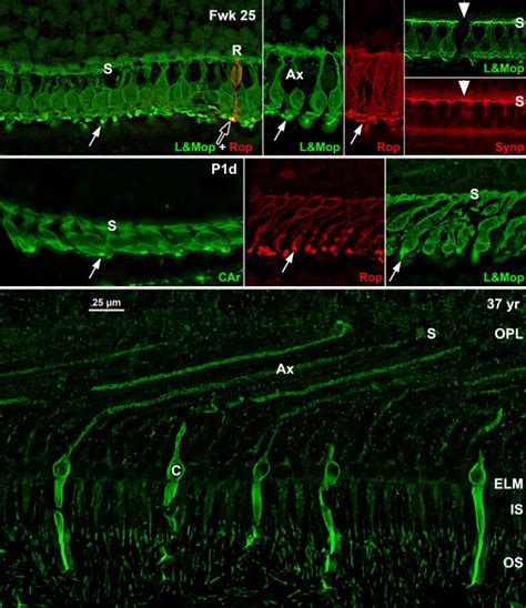 Histologic Development Of The Human Fovea From Midgestation To Maturity