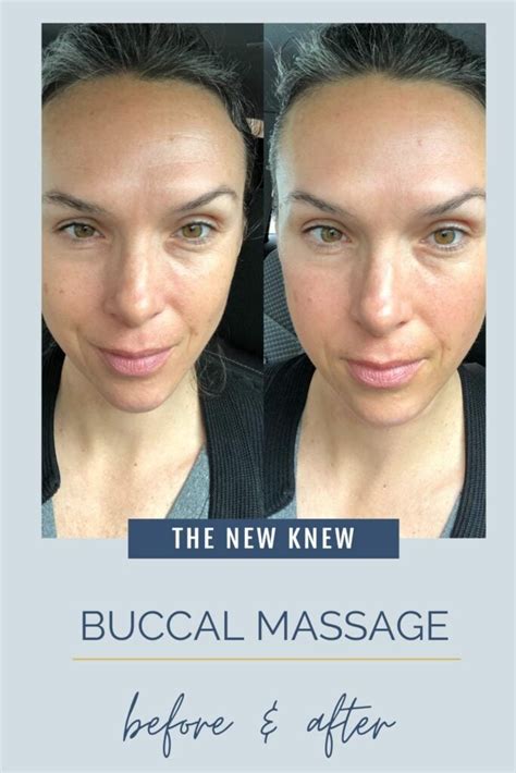 Buccal Facial Massage Personal Review With Photos The New Knew