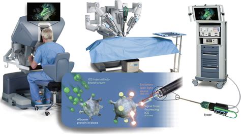 Fluorescence Image Guided Robotic Surgery Abdominal Key