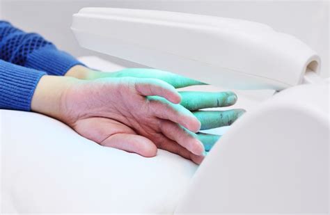 Phototherapy For Eczema How Uv Light Therapy Can Help