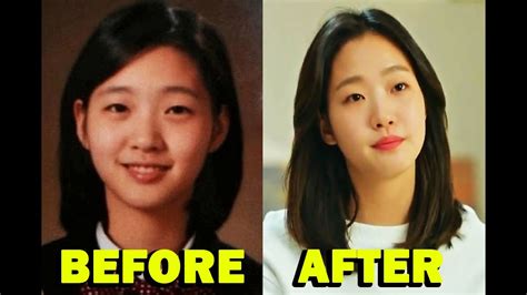 Kim Go Eun Before And After Youtube