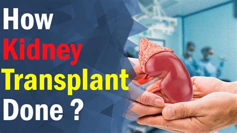 How Renal Transplant Takes Place Kidney Expert And Treatment Usa