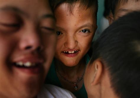 Anorak News Vietnams Children Of Agent Orange Photos Of A Lives