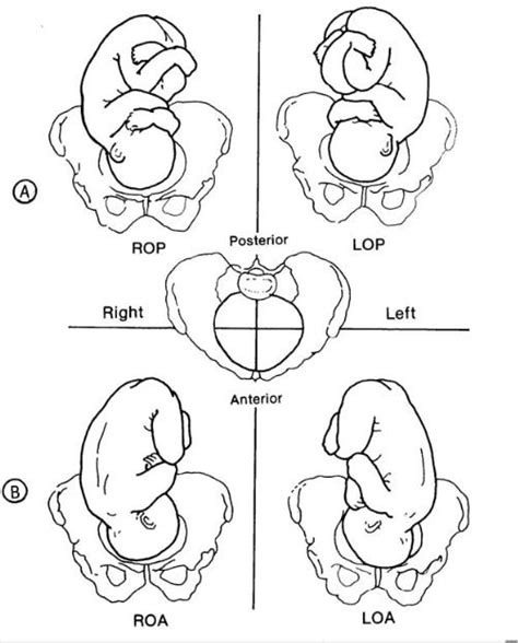 Anthro Doula Optimal Fetal Positioning