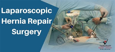 Advantage Of Laparoscopic Hernia Repair Surgery Over Open Surgery