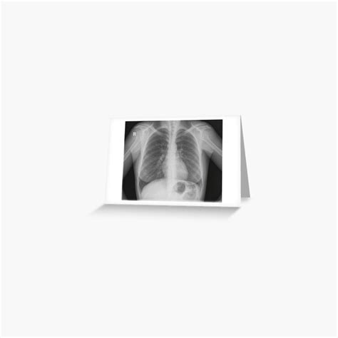 Chest X Ray Greeting Card By Rcmarble Redbubble