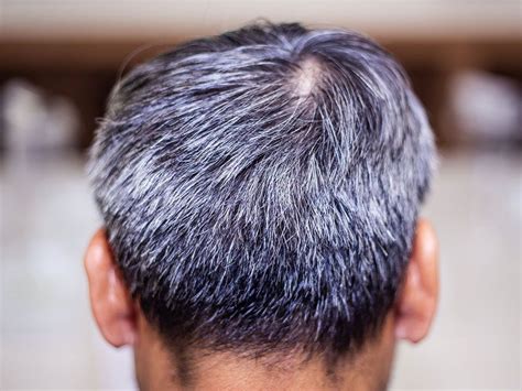 Why Does Hair Turn Gray Britannica