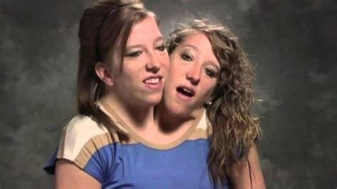 Inside Conjoined Twins Abby And Brittany Hensels Quiet Life Today
