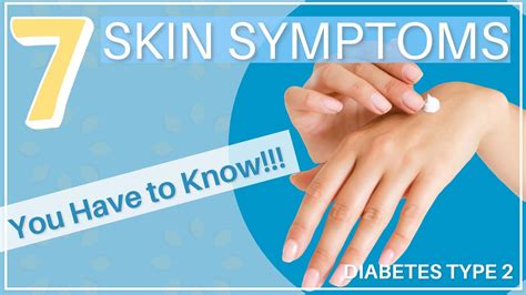 7⃣ Type 2 Diabetes Skin Symptoms That You Have To Know 🤔 Youtube