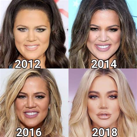 Khloe Kardashian 2012 2018 Yılları Arası Değişimi Beforeafter