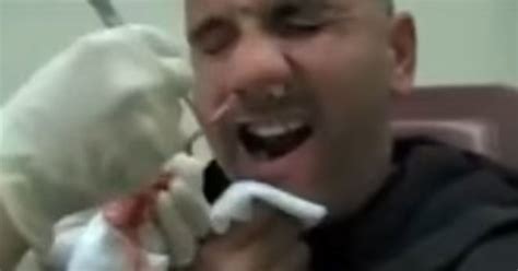 Man Reels As One Seriously Giant Tapeworm Is Removed From His Nose Funny Stories On The Net