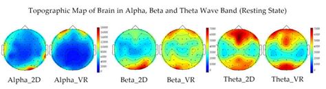Eeg Topographic Map In Alpha Beta And Theta Wave Frequency Bands In