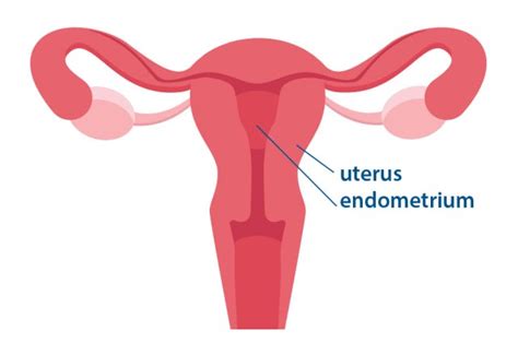 3 Facts About Endometrial Cancer Whats Up At Upstate Suny Upstate