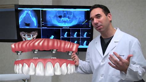 All On 4 Dental Implants Explained Dental Clinic
