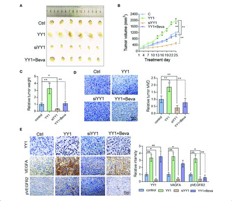 Yy Enhanced Tumor Vascularization In Hcc Xenograft Model By