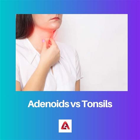 Adenoids Vs Tonsils Difference And Comparison