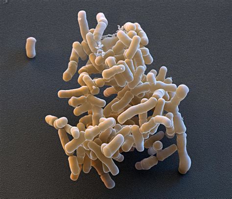 Bifidobacterium Breve Sem Photograph By Meckesottawa Pixels