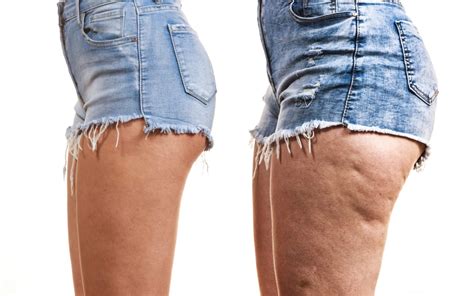 Agregar más de 60 pantalon celulitis mejor vietkidsiq edu vn