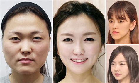 Plastic Surgery In South Korea Is So Good People Are Free Nude Porn