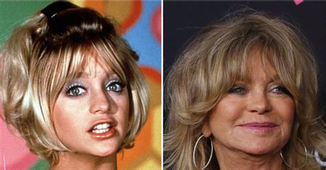Goldie Hawns Transformation Over The Years See Photos Goldie Hawn Plastic Surgery Photos