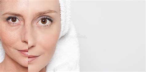 Aging Process Rejuvenation Anti Skin Procedures Stock Photos Free