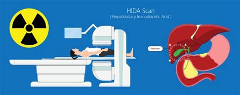 How A Hida Scan Can Help Your Overall Health Diagnosis Space Coast Daily