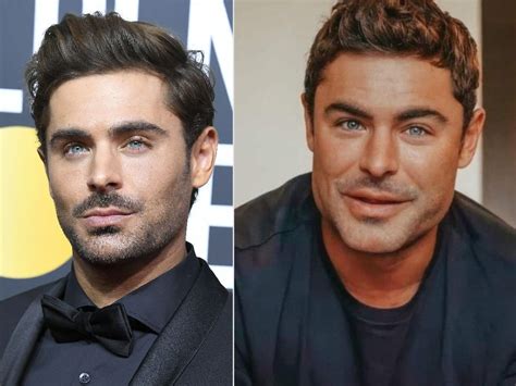 zac efron addressed the jaw gate speculation that he had plastic surgery saying he shattered