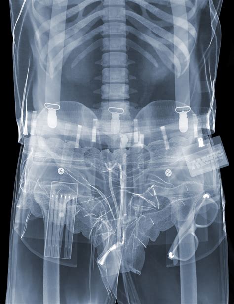 X Ray Voyeurism Nick Veasey S Images Explore What Lies Beneath PICTURES HuffPost UK