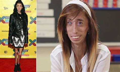 Lizzie Velasquez World S Ugliest Woman Insists She S Better Off Thanks To Bullies Daily Mail