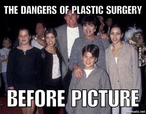 Kardashians Before Plastic Surgery Gag