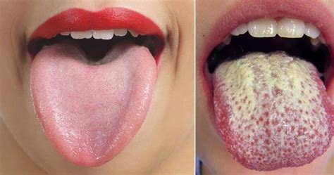 10 Secrets You Didnt Know Lie Inside Your Mouth With Pictures