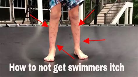 How To Not Get Swimmers Itch Youtube