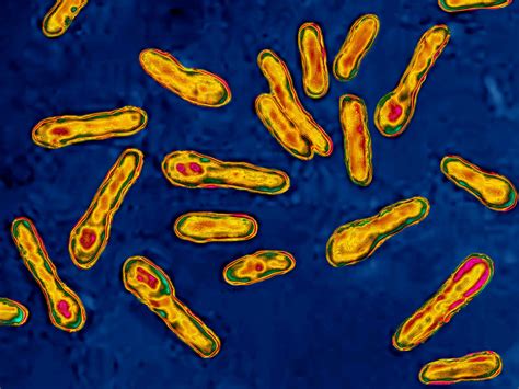 There are different forms of botulism, including foodborne botulism, wound botulism, and infant botulism. Hypotonic infant... Botulism - MEDizzy Journal