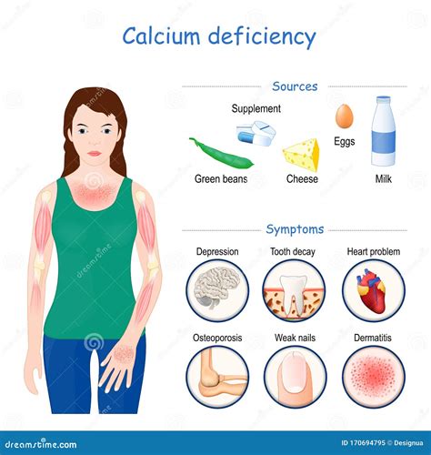 calcium deficiency symptoms good sources of calcium calcium rich foods hot sex picture