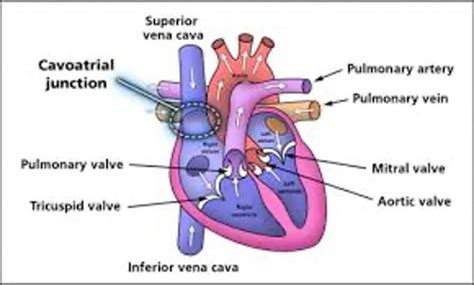 Central Venous Access Devices And Advanced Iv Therapy Concepts Exam 2