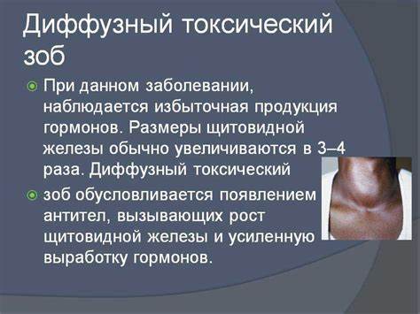 Меню безйодовая диета Зоб щитовидной железы: классификация, симптомы и лечение зоба щитовидки Зоб щитовидной железы: классификация, симптомы и лечение зоба щитовидки Меню безйодовая диета